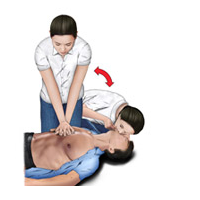 자동심장 충격기(AED) 사용방법 5