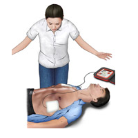 자동심장 충격기(AED) 사용방법 3